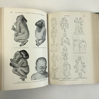 Vintage Medical Book 1939 Principle And Practice Of Obstetrics Delee Illustrated