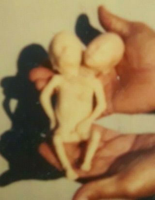 3 PHOTOS OF MY TWO HEADED BABY FREAK SIDE SHOW VINTAGES 70 ' STHE WORLDS STRANGEST 5