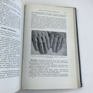 Vintage Medical Book 1939 Occupational Diseases Of The Skin Photos Medicine