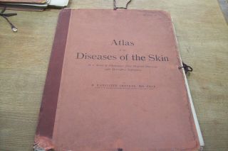 1903 Atlas Of The Diseases Of The Skin By Crocker,  96 Large Colour Plates,  Text