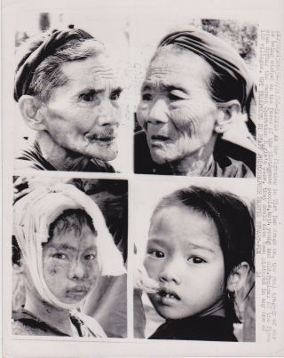 Martin Stuart - Fox: Faces Of Victims Vietnam War Vintage 1966 Press Photo