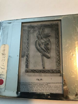 Vintage Lantern Slide,  Vesalius Human Heart Anatomy,  U Of Oklahoma Med.