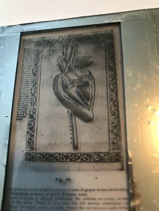 Vintage Lantern Slide,  Vesalius Human Heart Anatomy,  U of Oklahoma Med. 2
