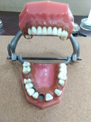 Vintage Visidon Articulating Dentoform Dentist Study Teeth