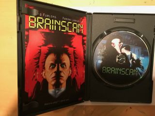 Brainscan DVD 3
